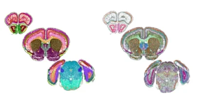 consiguen-crear-mapa-de-un-cerebro-detallado-nivel-celular-wide_webp